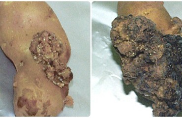 CFIA Completes Potato Wart Investigation in Prince Edward Island